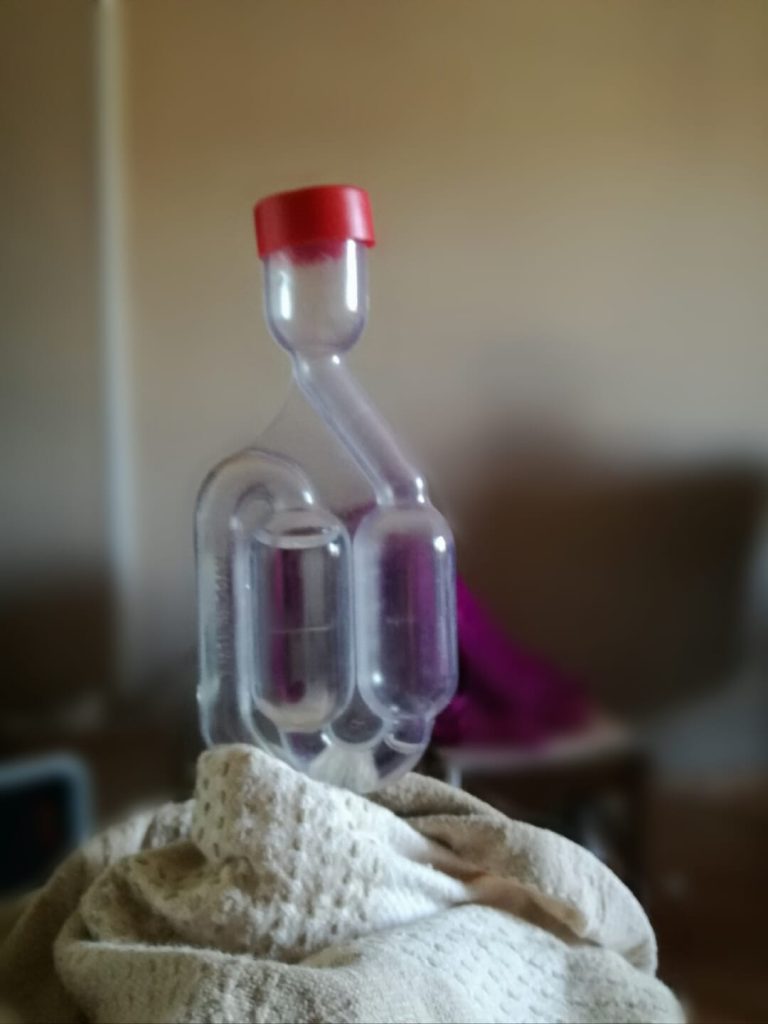 Fermentazione del mosto non parte